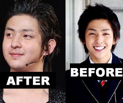 ya,kibum do plastic surgery,but he so poor cause the plastic surgery was failed...i have a pic for e.l.f take a look...but kibum still have e.l.f for support...KIBUM HWAITING,SARANGHAEYO....but he never out from suju,he dont come to super show cause he so busy with his acting....GAMBATEH