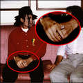 MJ's vitiligo - michael-jackson photo