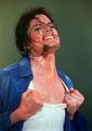 pic showing patched from MJ's vitiligo - michael-jackson photo
