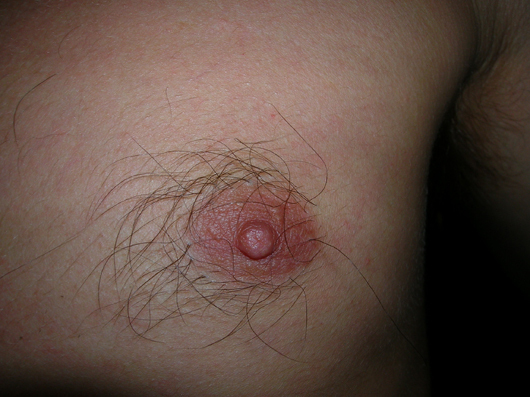 Hairy Nipple Pic 64