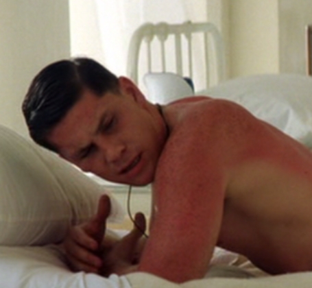  What actor plays the sunburnt guy?