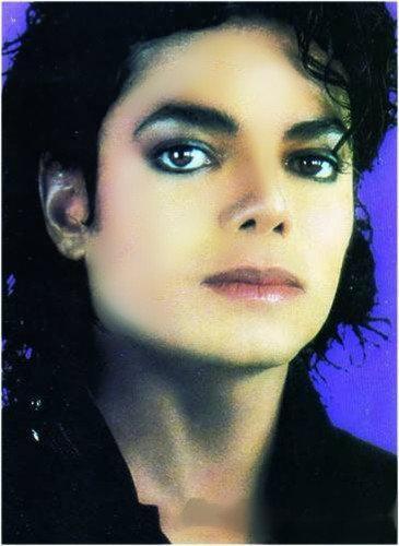  I believe that with the plastics he take the vitiligo. If he didnt did them he will be fine.