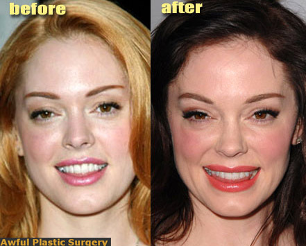  what do te think of her plastic surgery???