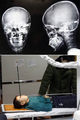 15 Bizzare X-Rays - unbelievable photo