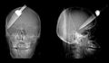 15 Bizzare X-Rays - unbelievable photo
