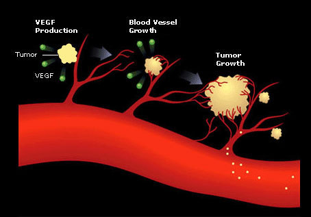 angiogenesis