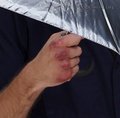 Rob's fake bruises for Remember Me - twilight-series photo