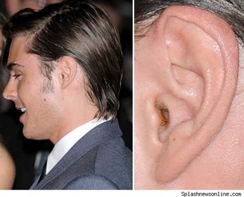  ear wax