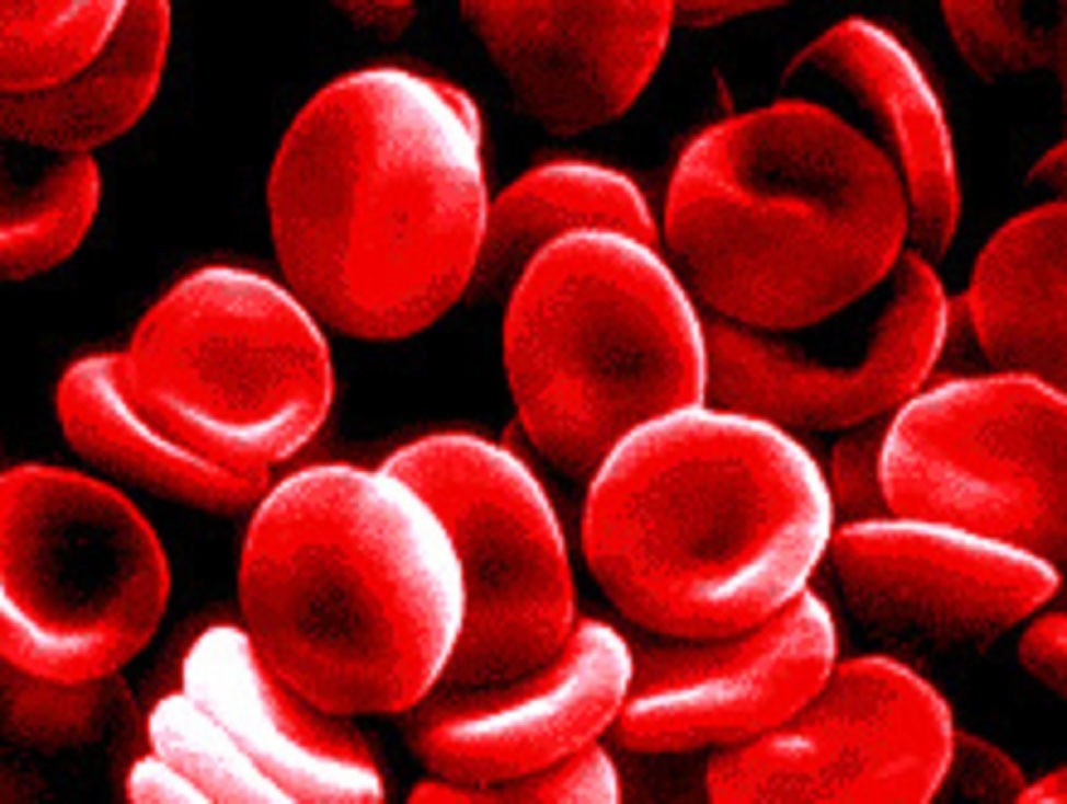 Are you Hemophobia (having a fear of blood)? Poll Results ...