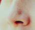  This nose belongs to: