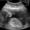 My baby girl Kieran, will be here in early April JKMcD photo