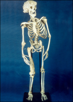  Joseph's skeleton