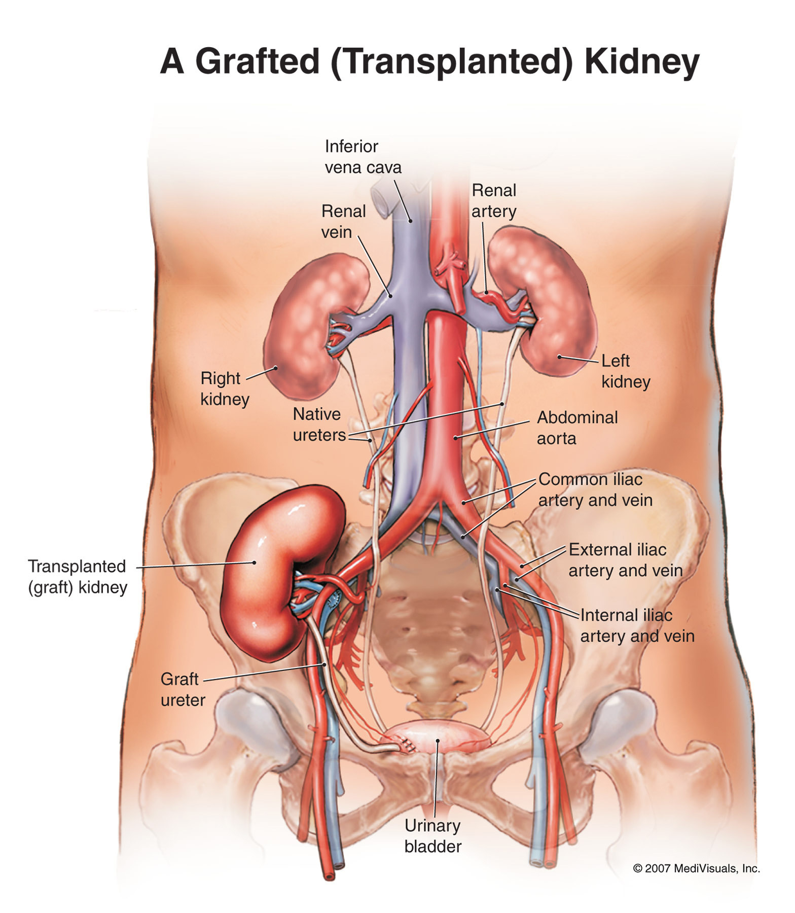  Kidneys