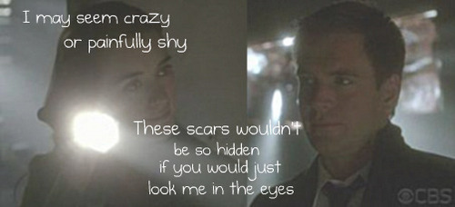  These scars...