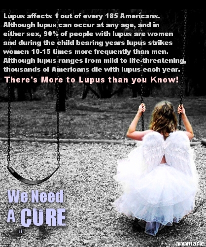  Lupus Affects Everyone