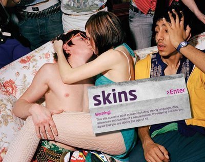  Skins（スキンズ） <3