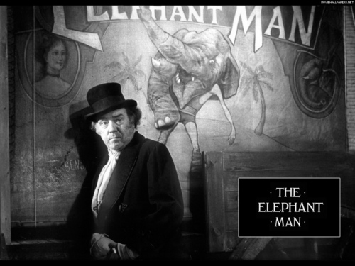  The слон Man
