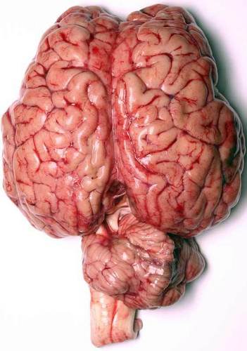  The Human Brain