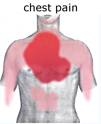 common chest pain areas