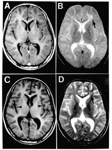  Brain MRI